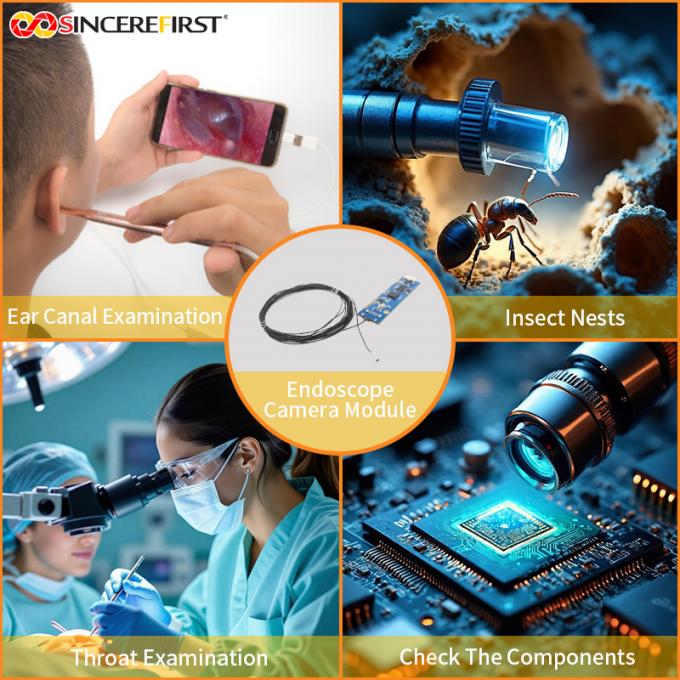 1.6mm-Class Ultra-Micro Endoscope Camera Module Industry Analysis ...