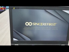 Sony IMX415 Sensor 8MP 4K USB2.0 Small Camera Module